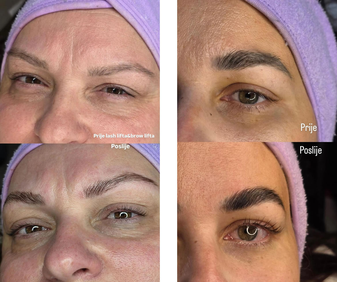 Brow Lift & Lash Lift